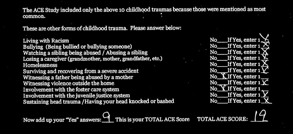 Printed Adverse Childhood Experience survey questions
